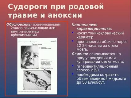 Синдром травмы