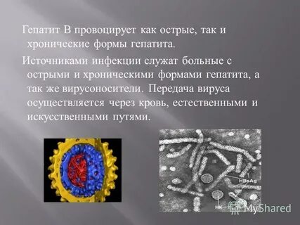 Вирусный гепатит формы