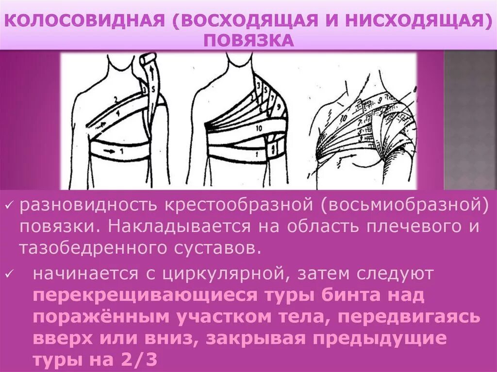 Плечевая повязка алгоритм. Колосовидная повязка на плечо показания. Нисходящая колосовидная повязка на плечевой сустав. Десмургия повязка колосовидная на плечо. Повязка колосовидная на плечо и плечевой сустав.