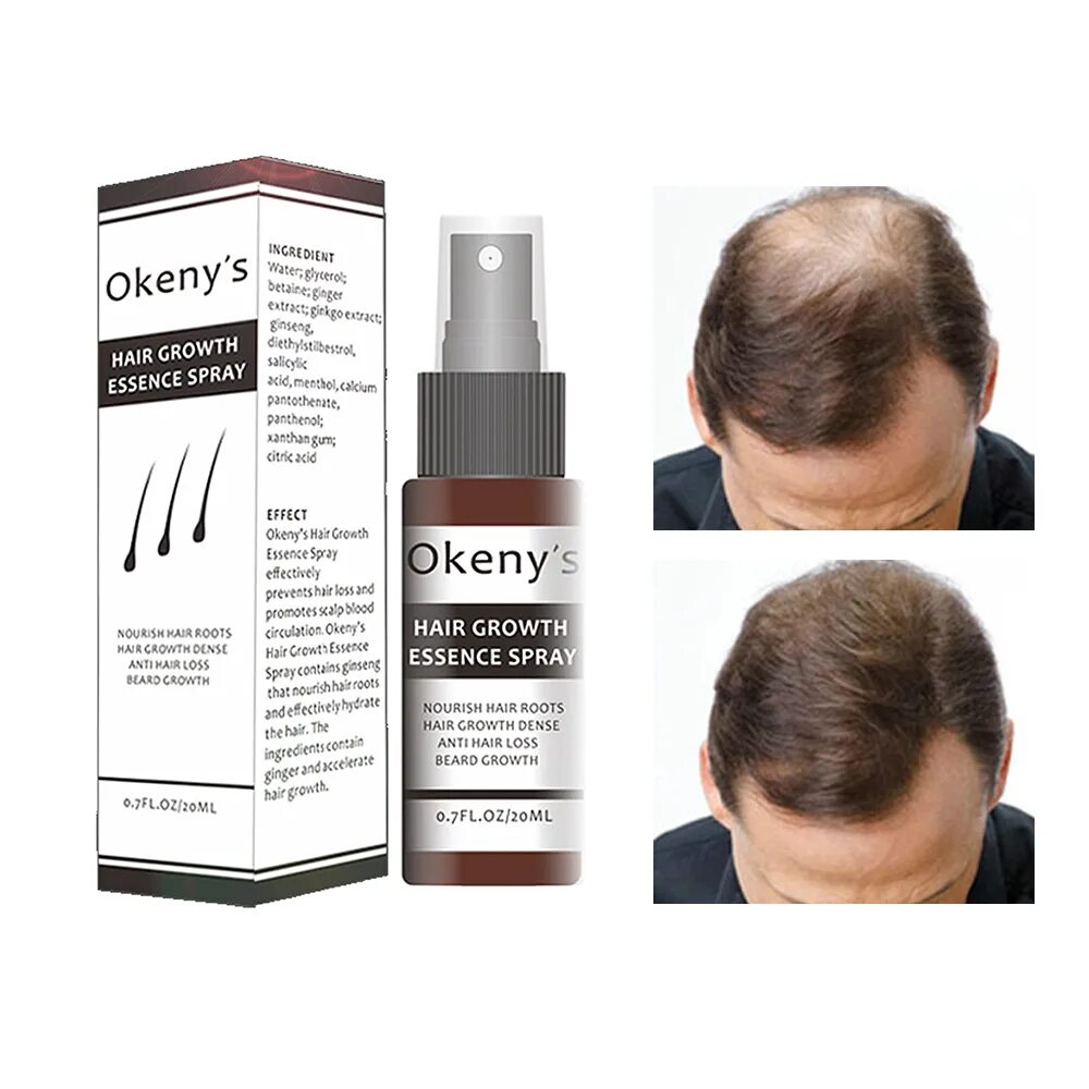 Сыворотка для волос для мужчин. Hair loss treatment от выпадения. Китайская эссенция hair growth Spray. Средство для облысения для мужчин. Спрей для волос для мужчин от облысения.