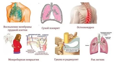 При кашле отдает в грудную клетку