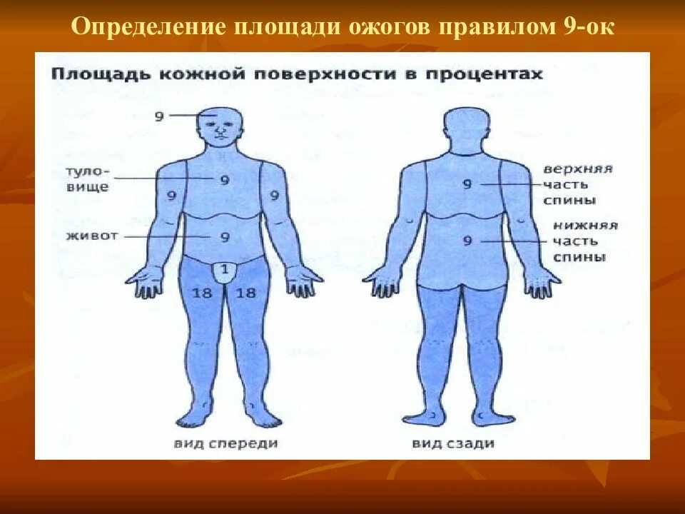 Площадь поражения при ожогах. Площадь ожогов правило девяток. Определение площади ожогов. Способы измерения площади ожогов.