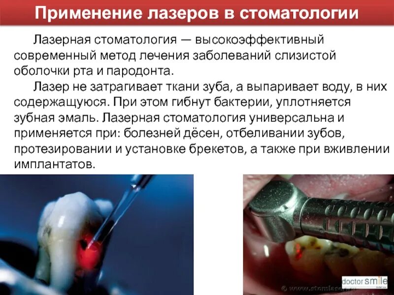 Методы лечения заболевания современные методы. Лазерное излучение в стоматологии. Лазеры применяемые в стоматологии. Аргоновый лазер в стоматологии.
