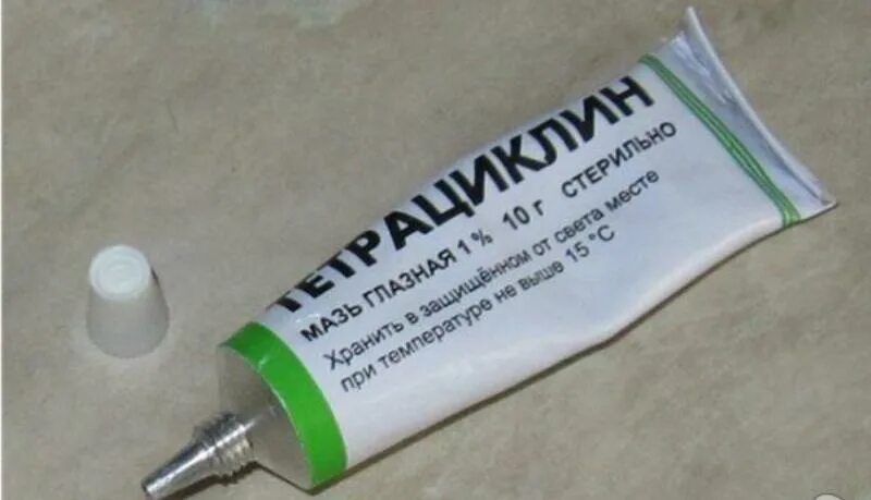 Электроофтальмия - воспаление наружной оболочки глаз. Компресс на глаза. Глазные капли от ожогов от сварки. Капли от ожога глаз. Если глаза сваркой что делать.