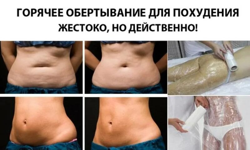 Обметывание для похудение. Обертывание живота. Помогает ли обертывание похудеть. Обметывание для похудение. Eveline anti cellulite обертывание.