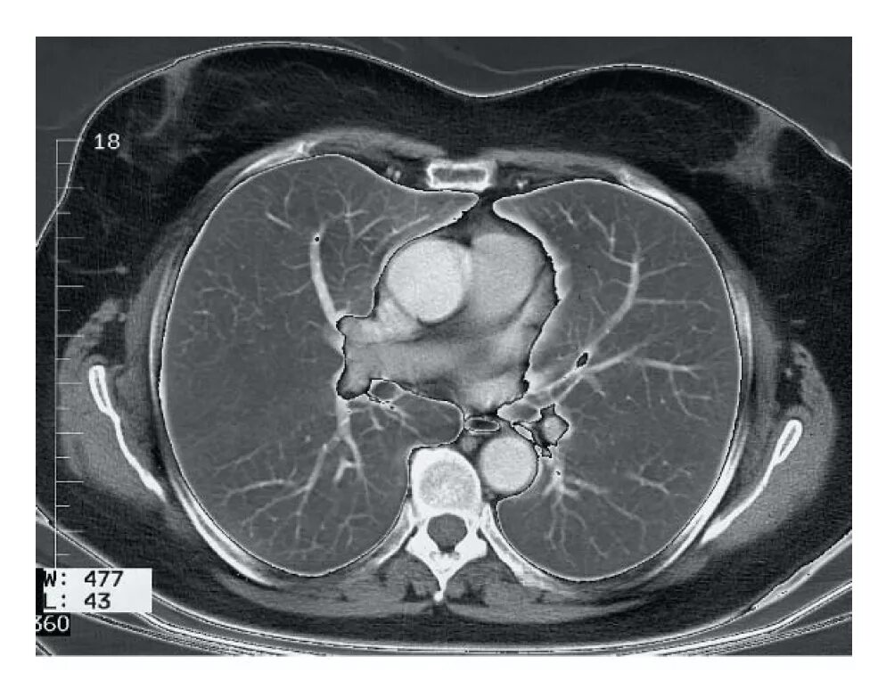 Боковой срез на кт. Кт анатомия обп. Срезы при кт. Срезы на кт виды. Диагнокад срезы кт.