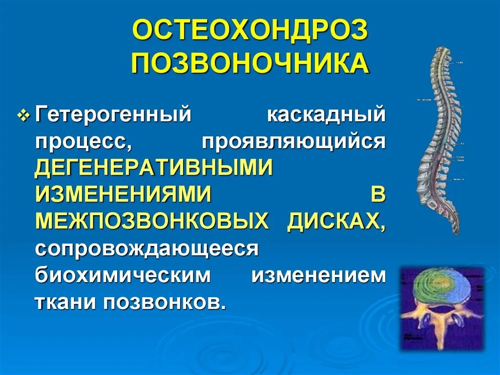 Остеохондроз позвоночника. Дегенеративные изменения позвоночника. Остеохондроз позвоночника неврология. Неврология остеохондроз позвоночника презентация.