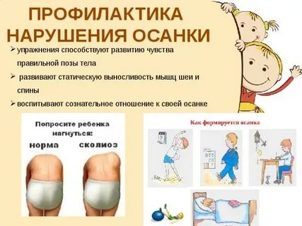 Профилактика нарушений осанки у детей