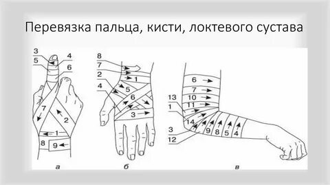 Как делать перевязку