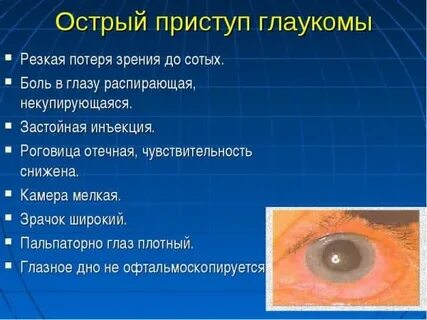 Признаки глаукомы глаза симптомы