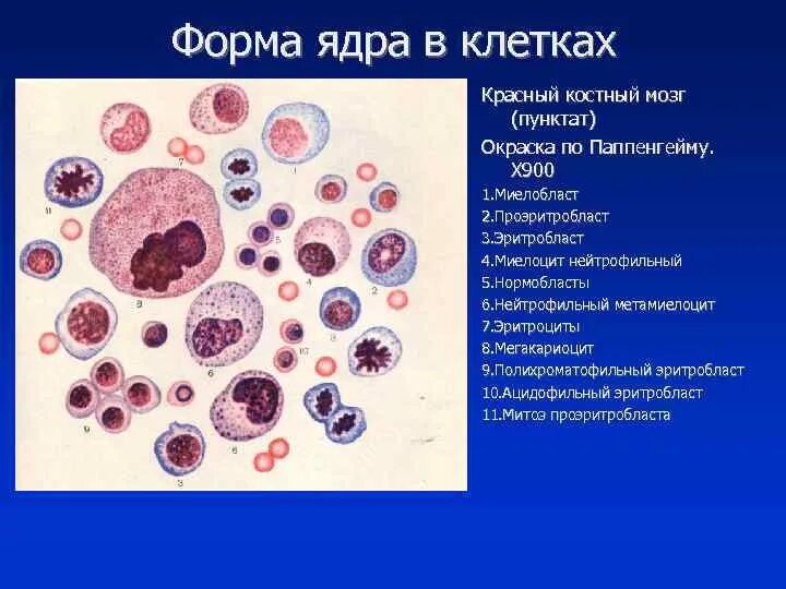 Красный костный мозг пунктат окраска по Паппенгейму. Форма ядра в клетках уплощенной формы:. Клетки костного мозга. Формы клеточных ядер. Клетки с гиперхромными ядрами