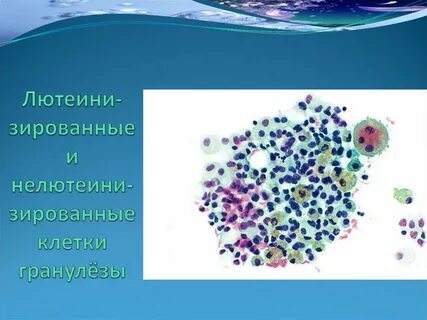Гранулез