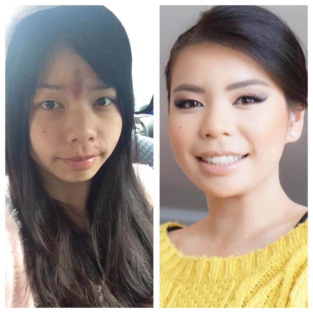 My before
