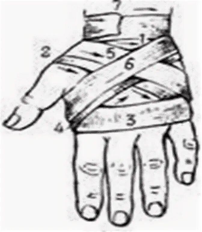 Техника наложения крестообразной повязки. Бинтовая повязка на кисть. Бинтовая повязка на лучезапястный сустав. Крестообразная повязка на колено. Бинтовая повязка на кисть и лучезапястный сустав.