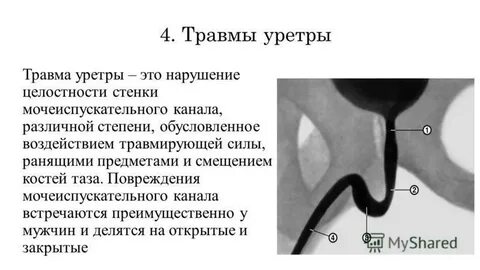 Длина мочеиспускательного канала