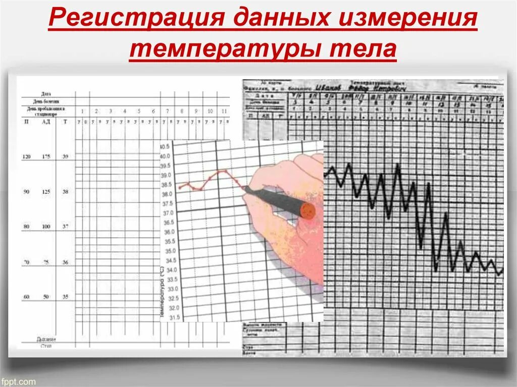 Регистрация данных измерения температуры тела в температурном листе. Запись пульса в температурный лист. Запись температуры в температурный лист. Температурный лист детский. Была измерена температура тела