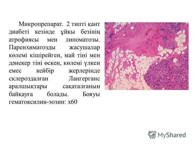 Печень микропрепарат описание