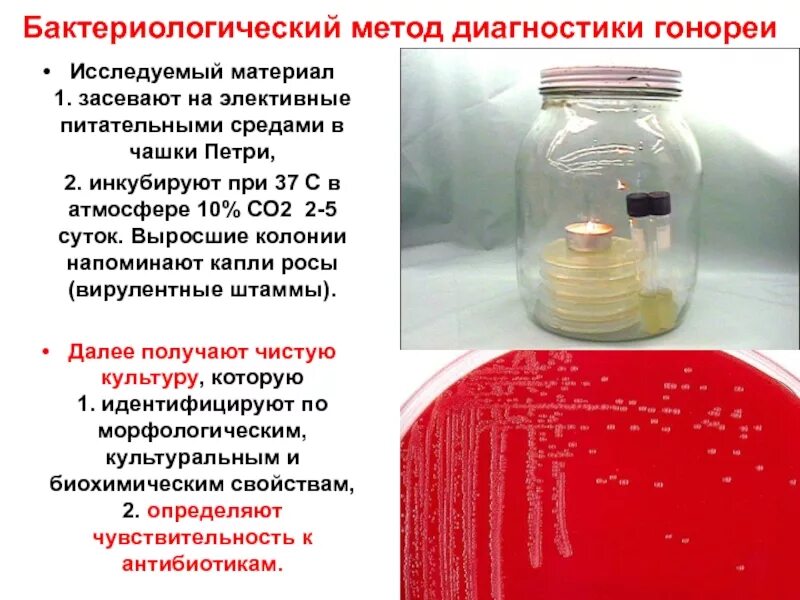 Бактериологический метод. Бактериологический метод диагностики. Гонорея на питательной среде. Методы бактериологической диагностики. 2 этап бактериологического метода