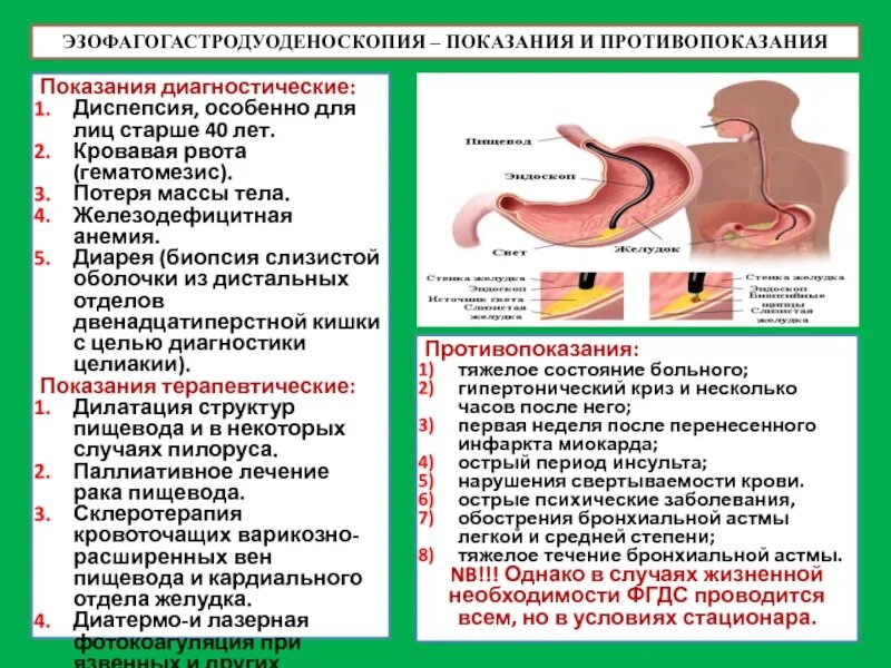 Эзофагогастродуоденоскоп используется для осмотра слизистой оболочки. Фгдс противопоказания для проведения. методика выполнения эгдс. эзофагогастродуоденоскопия пищевода.
