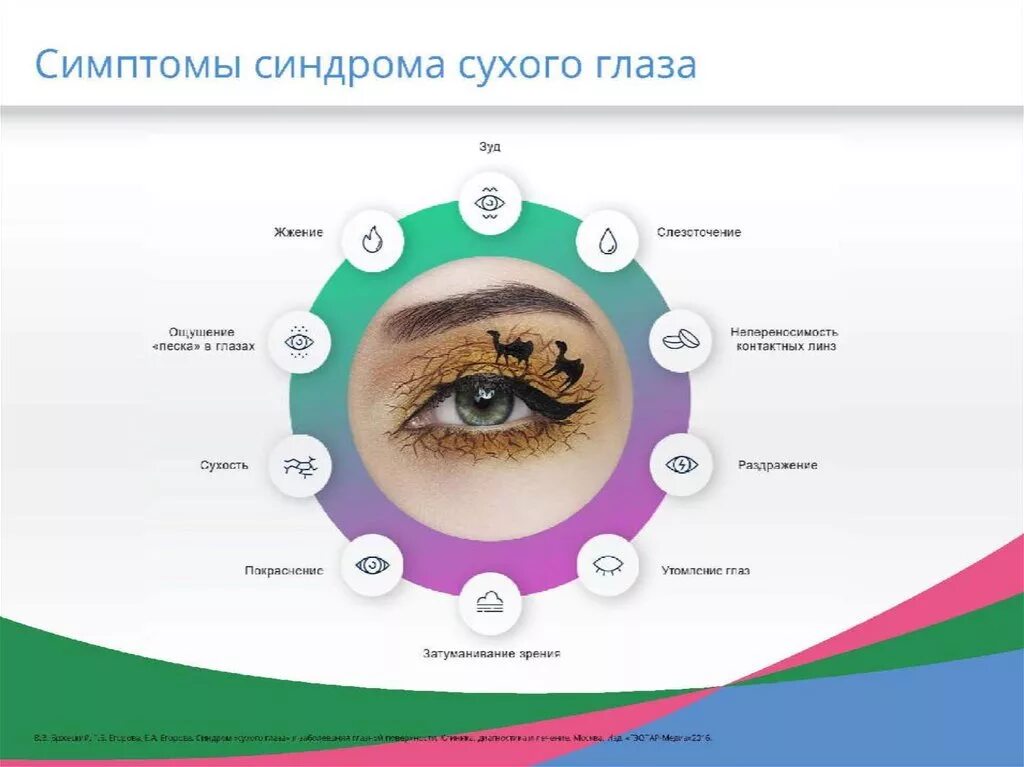 Глазки сухо. Симптомы чиндрома сузого новща. Сидромсухового глаза. Синдром сухого глаза симптомы.