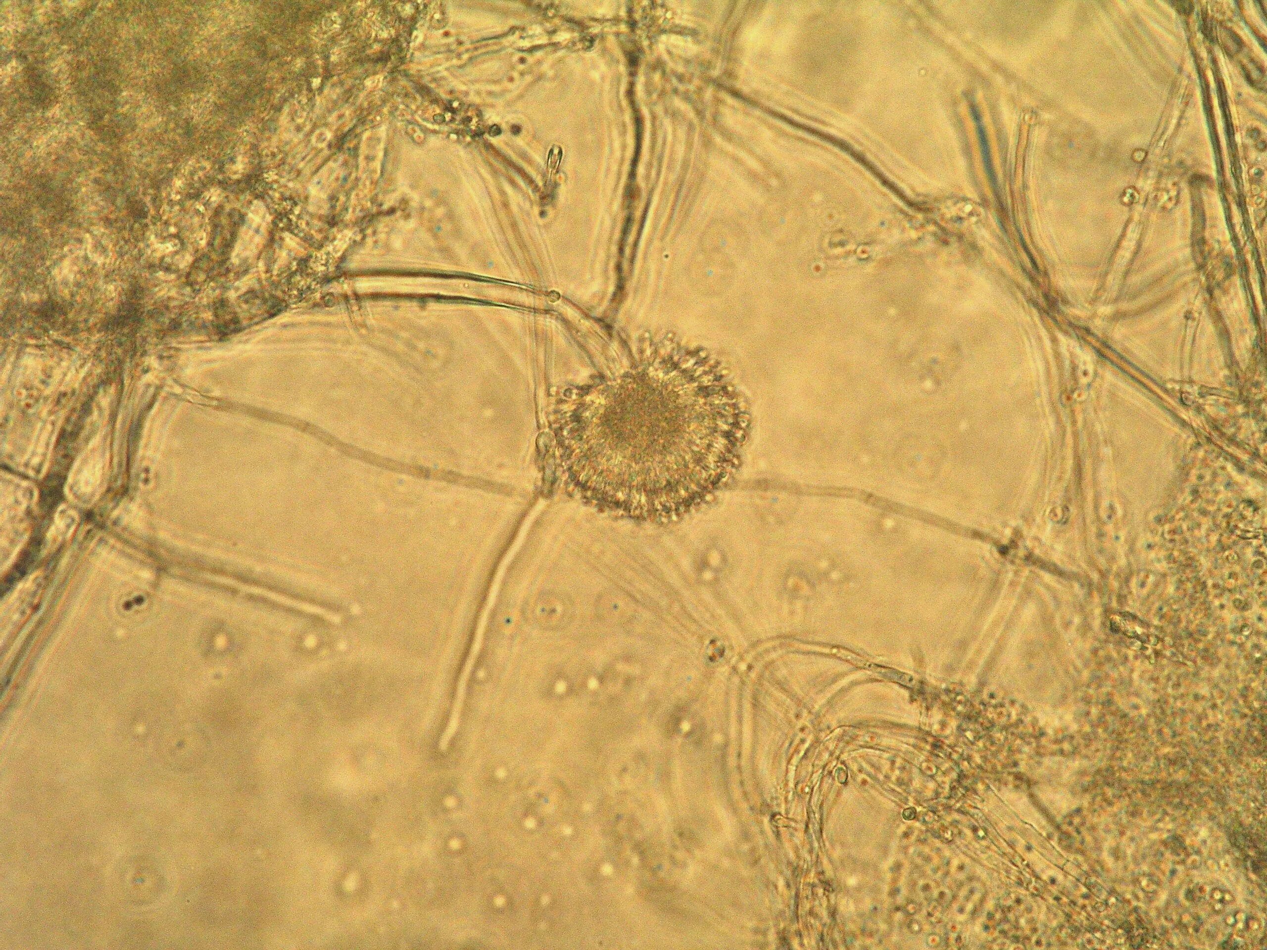 Обнаружены споры и мицелий. Гриба Aspergillus ochraceus. Aspergillus fumigatus микроскоп. Микроскопия аспергилл. Плесневые грибы конидии.