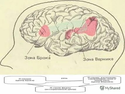 Зона брока и вернике за что отвечает
