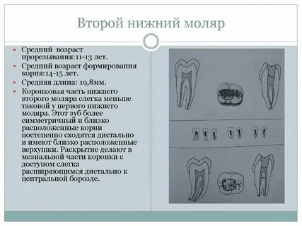 Моляр нижней челюсти