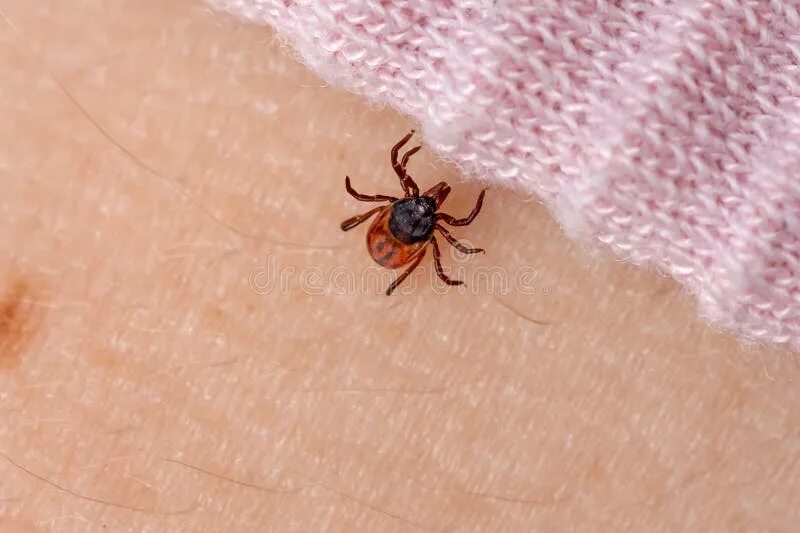 HOW TO SKIP THE PROBLEM OF BUGS UNDER THE SKIN Bug bite treatment, Insect bites 