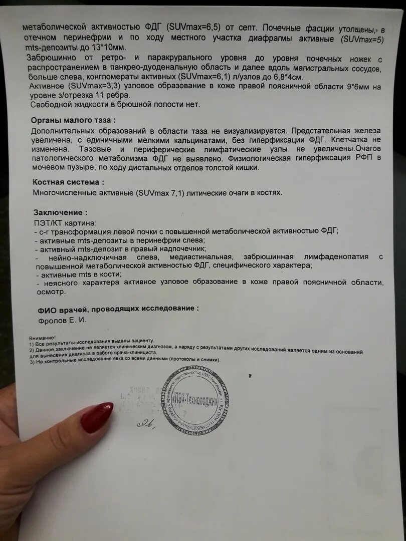 Что значит метаболическая активность. Очаг повышенной метаболической активности. Очаг повышенной метаболической активности ФДГ. ПЭТ кт заключение.