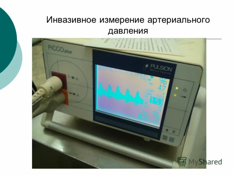 Неинвазивные методы измерения ад. Прямой метод измерения кровяного давления. Прямой метод измерения артериального давления. Прямое измерение артериального давления. Инвазивный способ измерения артериального давления.