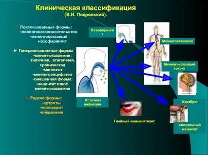 Локализованная форма инфекции