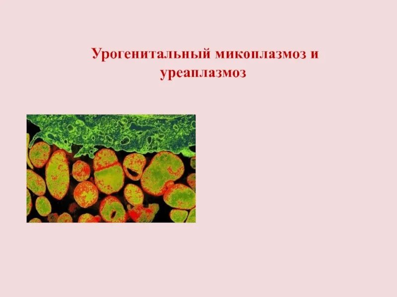 Урогенитальный микоплазмоз. Микоплазмоз презентация. Микоплазмоз клинические проявления. Урогенитальный уреаплазмоз.