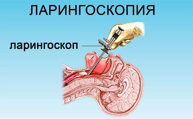 Ларингоскопия как проводится процедура. Прямая ларингоскопия гортани. непрямая ларингоскопия у детей.