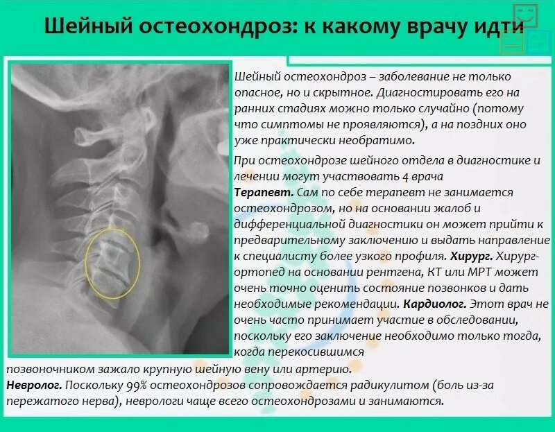 Остеохондроз шейного отдела какой врач
