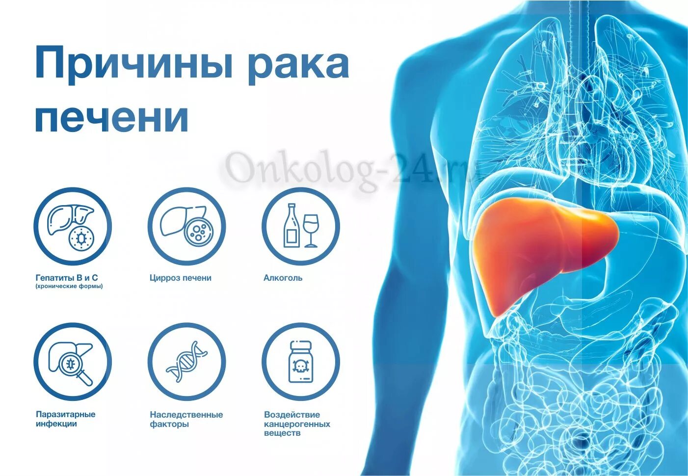 Рак печени стадии прогноз. Факторы риска онкозаболеваний. Карцинома печени клиника.