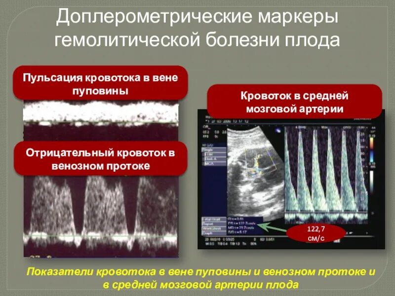 Венозна протока