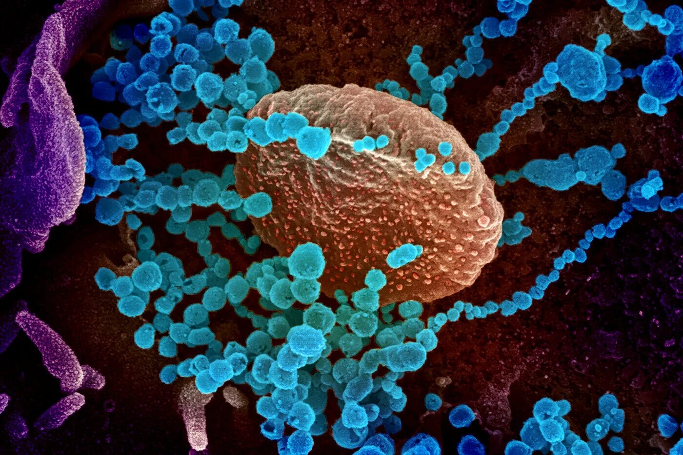 The virus can be. Коронавирус в микроскопе. SARS cov 19 под микроскопом. Вирус Covid 19 под микроскопом. SARS cov 2 микроскоп.