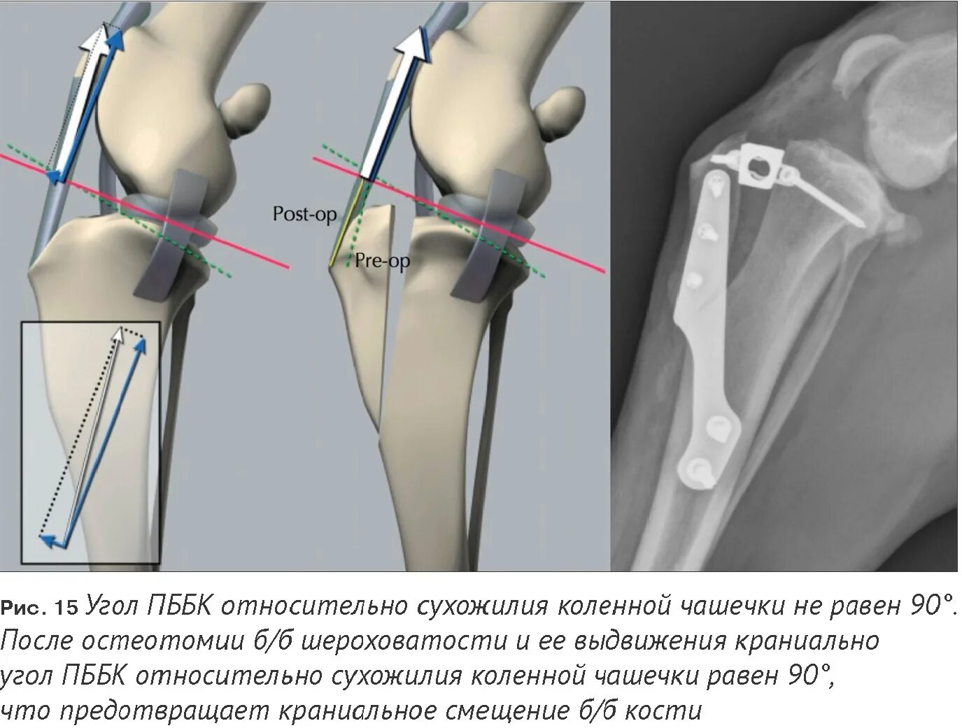 Разрыв связки у собаки. Транспозиция бугристости большеберцовой кости. Разрыв связок коленного сустава ПКС операция. Метод TPLO при разрыве связок.