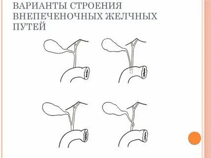 Внепеченочный желчный проток