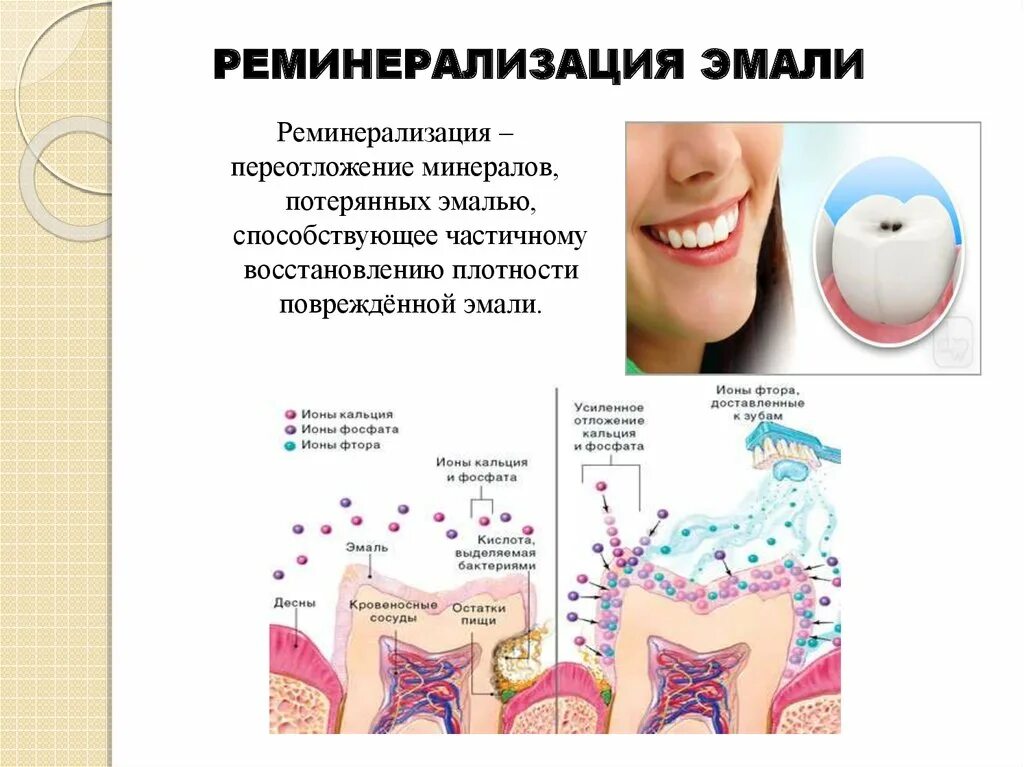 Биохимия зуба. Очаговая деминерализация зубной эмали. Процесс деминерализации эмали. Реминерализации тканей зубов. Процесс деминерализации и реминерализации эмали.