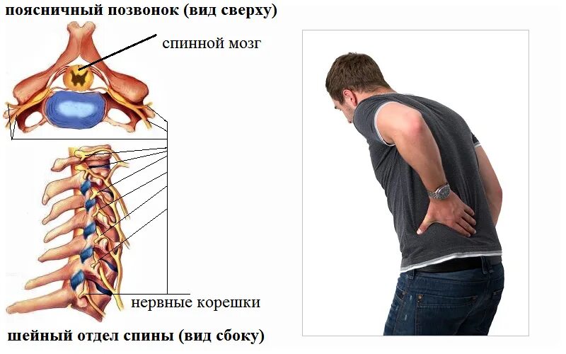 Болит спина. Болит посередине позвоночника. Болит спина посередине.