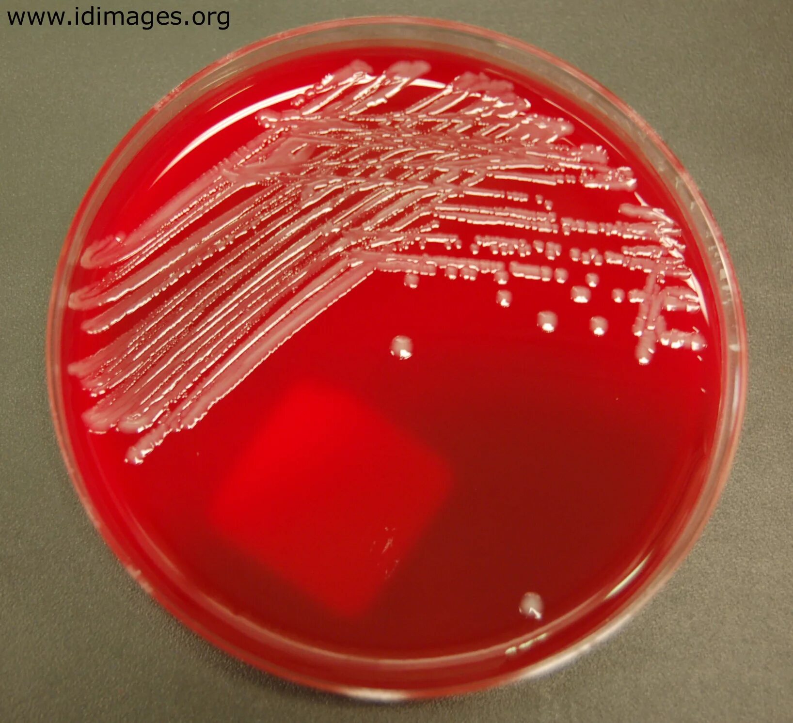 Сальмонелла (Salmonella). Сальмонелла enterica. Сальмонелла энтерика Тифи. Сальмонелла Тифи микробиология среда. Сальмонеллез б