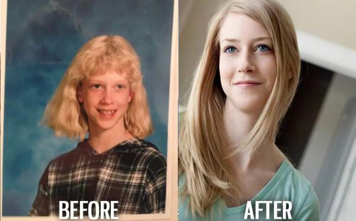 Что стало изменились. Девушки до и после взросления. Изменение внешности подростков. Дети до и после взросления. Люди до и после подросткового возраста.