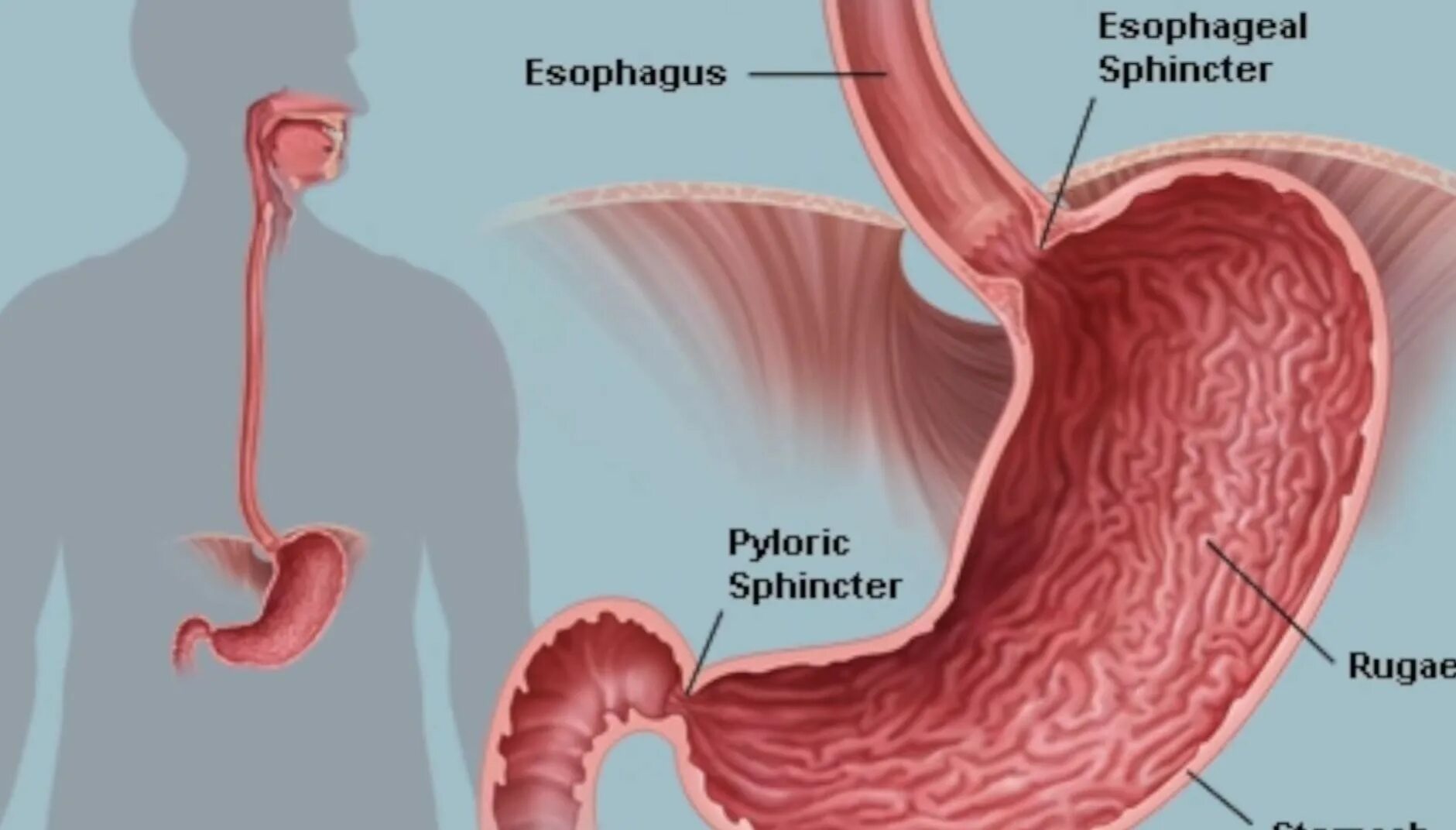 Проблемы с пищеводом. Нижний пищеводный сфинктер. Привратник желудка анатомия.