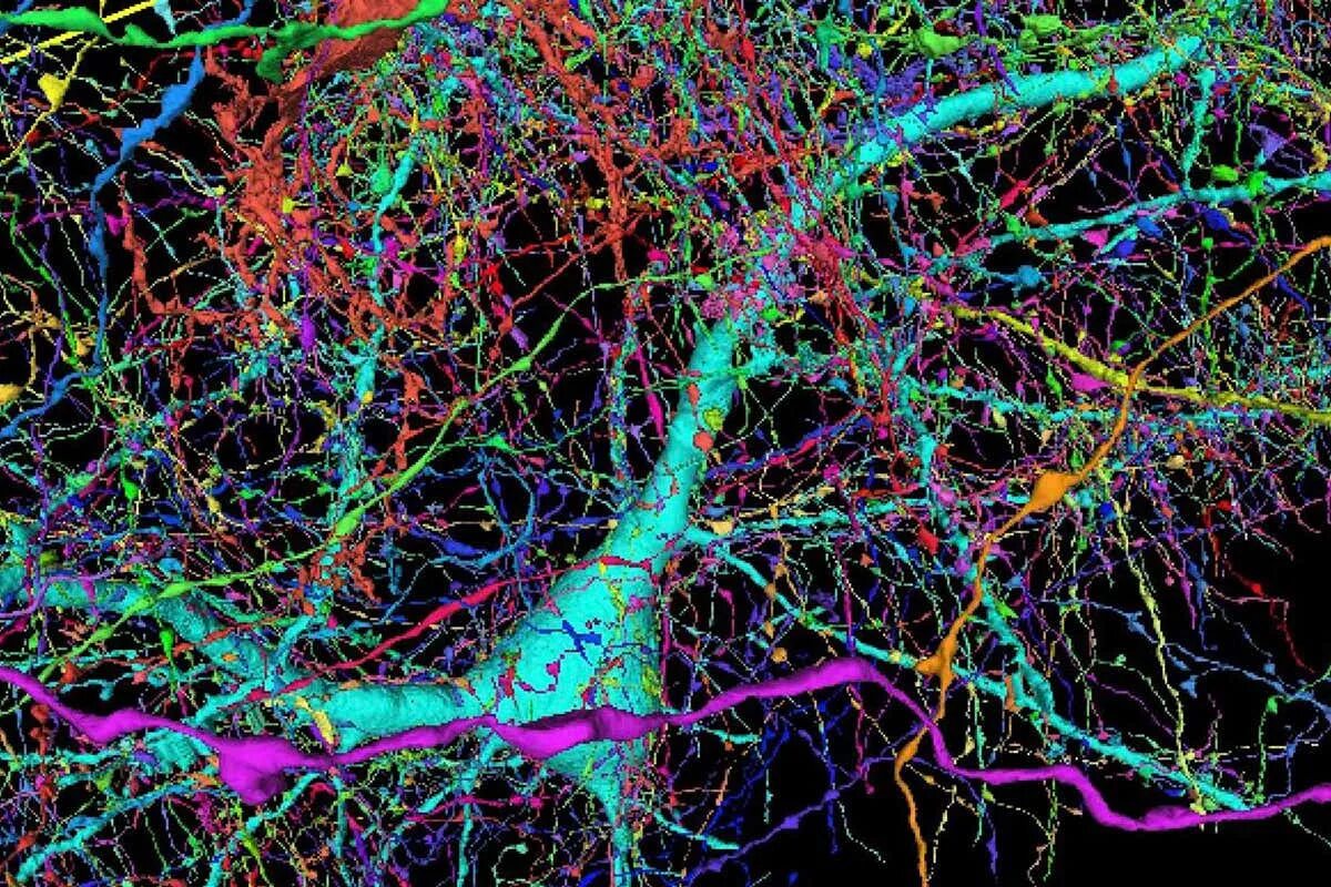 Long brain. Клетки мозга. Нейронные связи. Нейронные клетки головного мозга. Нейронные связи в мозге.