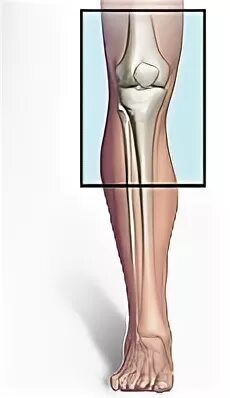 Болят кости ниже колена спереди почему