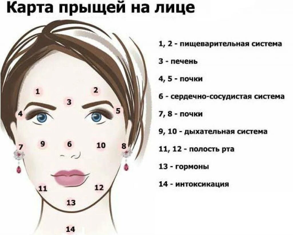 Прыщи на лице по зонам. Причина прыщей на лице у женщин. Зоны появления прыщей. Зоны прыщей на лице. Зоны прыщей на лице.