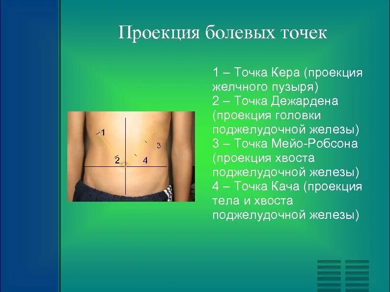 Проекция желчного пузыря на переднюю брюшную стенку. Точка дежардена и мейо-робсона. точка проекции желчного пузыря. точка желчного пузыря на животе. болевые точки желчного пузыря.