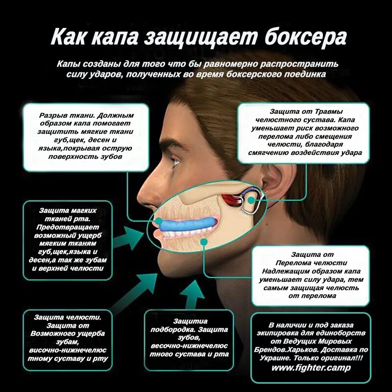 Боксерская Капа на нижнюю челюсть. Боксерская Капа на зубах. Капа для зубов для бокса. Капа для выдвижения челюсти.