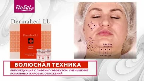 Ll липолитики